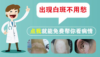 病因病理-白癜风的发病原因主要有什么_1